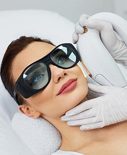 Dermaplaning in Chicago, IL
