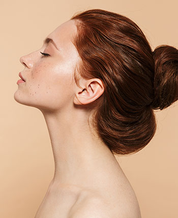 Jawline with Fillers in Chicago, IL