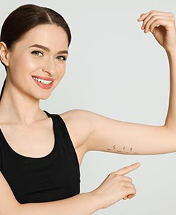 HD Arm Lipo 360 in Chicago, IL