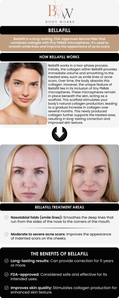 Common questions asked by patients: What is Bellafill? What does Bellafill treat? How long do the Bellafill results last? Am I a good candidate for Bellafill at Body Works Plastic Surgery? For more information, contact us or request an appointment online. We are conveniently located at 3918 W 63rd St, Chicago, IL 60629.