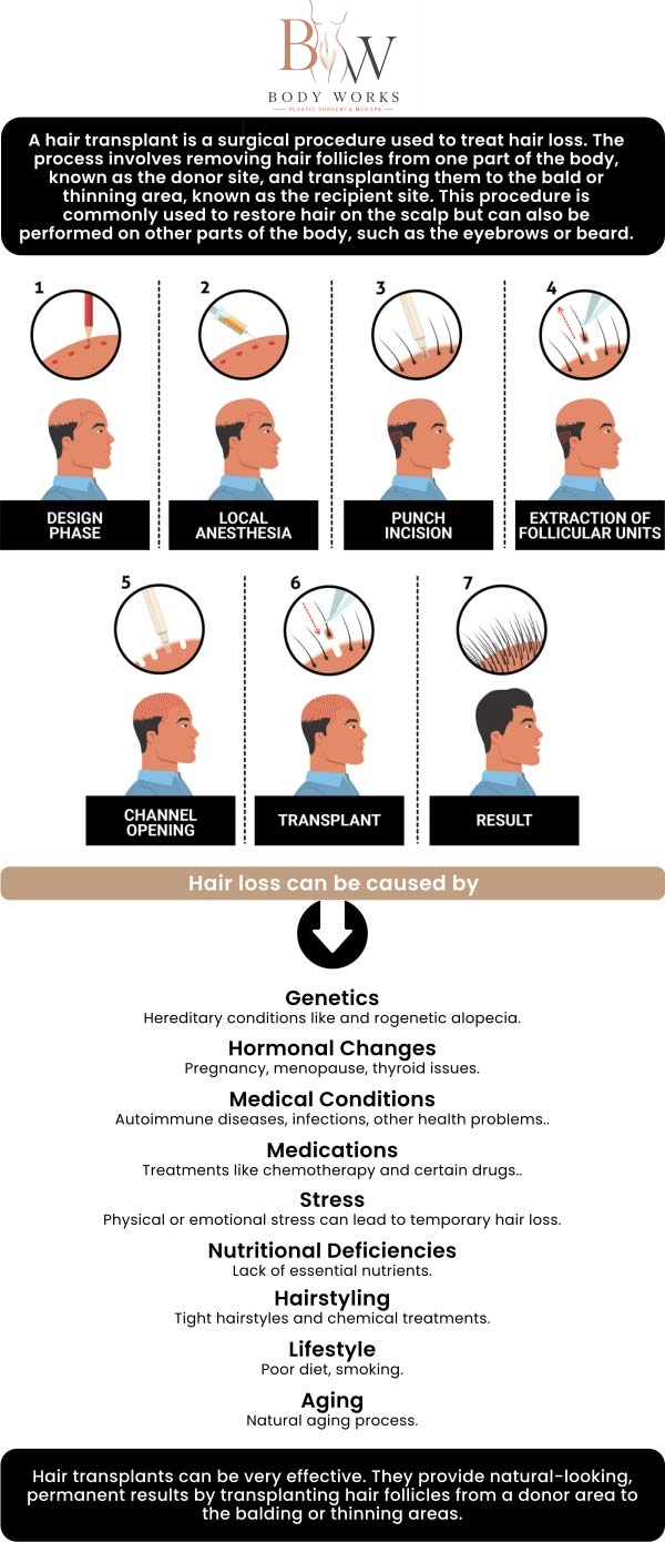 Common questions asked by patients: What is an FUE hair transplant? Does the FUE procedure leave a linear scar? How long does it take to see the final results from an FUE hair transplant? Am I a good candidate for an FUE hair transplant at Body Works Plastic Surgery? For more information, contact us or request an appointment online. We are conveniently located at 3918 W 63rd St, Chicago, IL 60629.