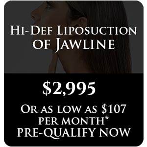 Hi-Def Liposuction of Jawline