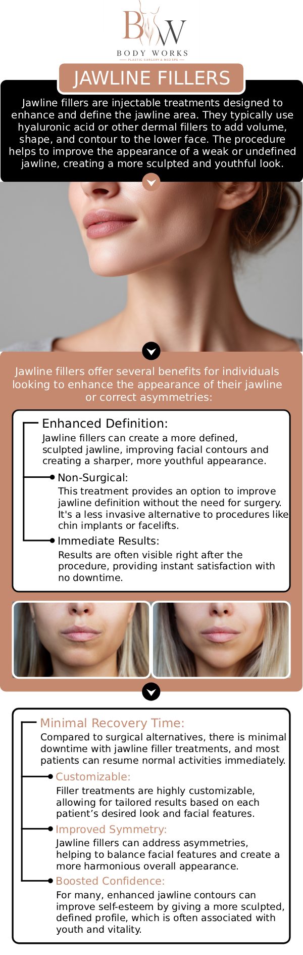 Common questions asked by patients: What are jawline fillers? How long do the results last from jawline fillers? Is there any downtime after jawline fillers? Am I a good candidate for jawline fillers at Body Works Plastic Surgery? For more information, contact us or request an appointment online. We are conveniently located at 3918 W 63rd St, Chicago, IL 60629.