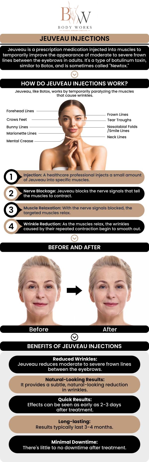 If you want to smooth away stubborn frown lines and achieve a more rested, youthful appearance, finding an experienced Jeuveau treatment specialist in Chicago, IL, is the perfect solution. At Body Works Plastic Surgery, our board-certified team utilizes this advanced neuromodulator to safely and precisely relax the underlying facial muscles responsible for deep wrinkles. For more information, contact us or request an appointment online. We are conveniently located at 3918 W 63rd St, Chicago, IL 60629.
