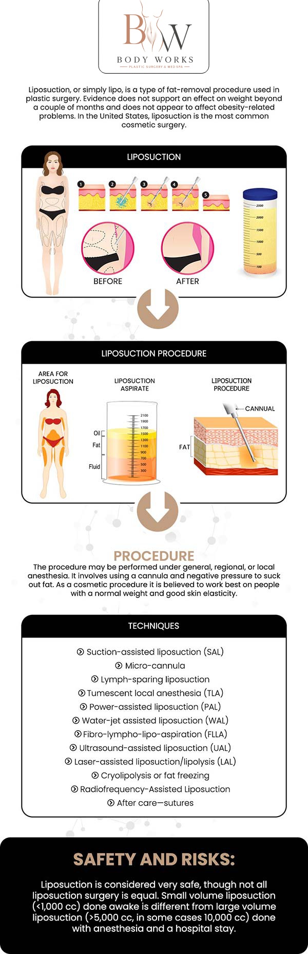 Common questions asked by patients: What is high-definition liposuction? How does high-definition liposuction differ from traditional liposuction? How long is the recovery time? How long will my results last after getting high-definition liposuction at Body Works Plastic Surgery? For more information, contact us or request an appointment online. We are conveniently located at 3918 W 63rd St, Chicago, IL 60629.