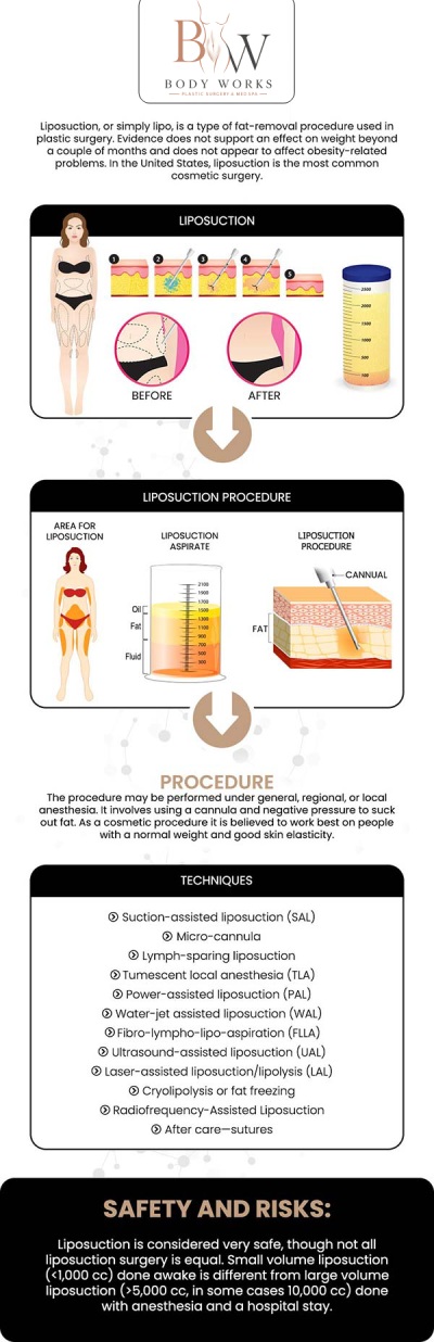 Common questions asked by patients: What is high-definition liposuction? How does high-definition liposuction differ from traditional liposuction? How long is the recovery time? How long will my results last after getting high-definition liposuction at Body Works Plastic Surgery? For more information, contact us or request an appointment online. We are conveniently located at 3918 W 63rd St, Chicago, IL 60629.