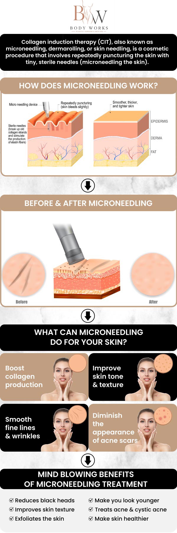 Common questions asked by patients: What exactly is PRP microneedling? Why add PRP to standard microneedling? What specific skin issues does PRP microneedling target? When will I see the final results from my PRP microneedling at Body Works Plastic Surgery? For more information, contact us or request an appointment online. We are conveniently located at 3918 W 63rd St, Chicago, IL 60629.