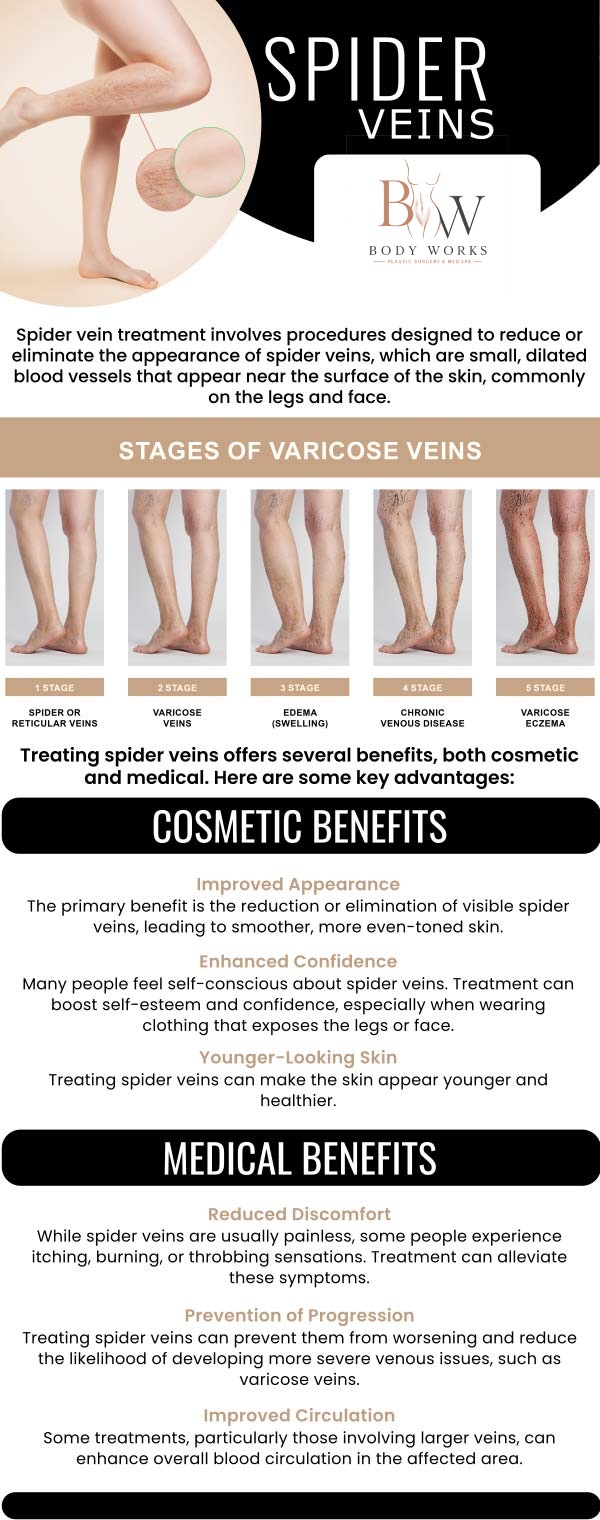Common questions asked by patients: What are spider veins? What causes spider veins to form? How are spider veins typically treated? Am I a good candidate for spider vein removal at Body Works Plastic Surgery? For more information, contact us or request an appointment online. We are conveniently located at 3918 W 63rd St, Chicago, IL 60629.