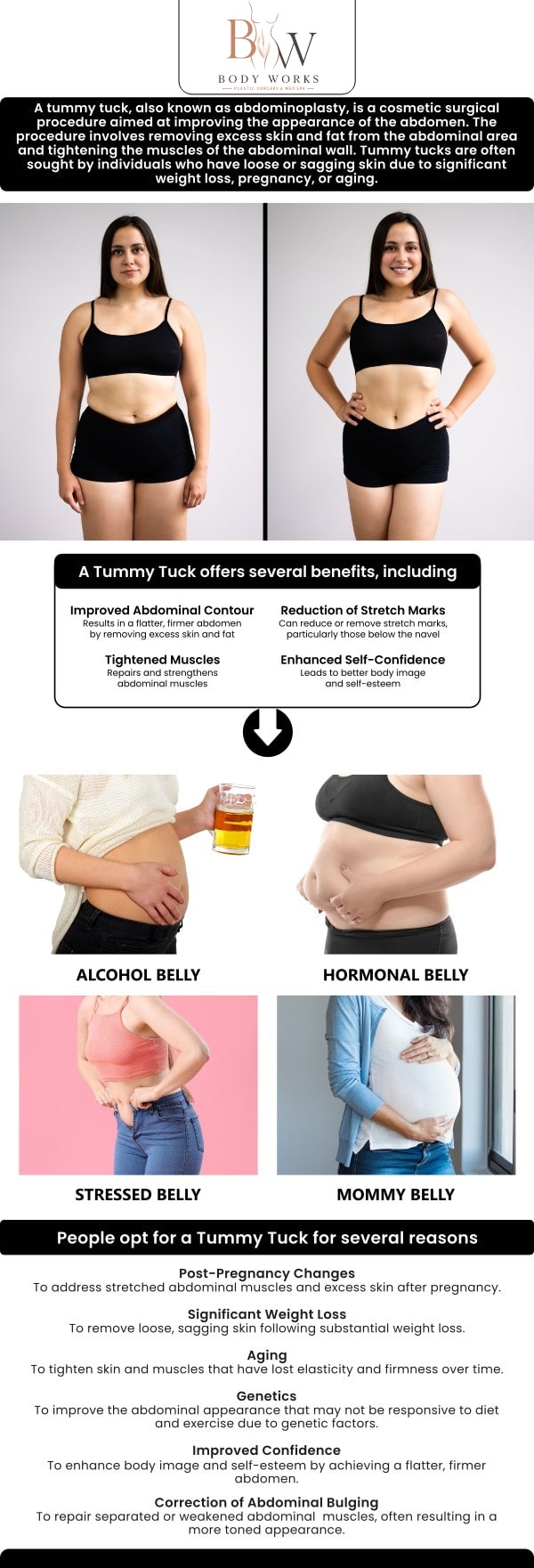 Common questions asked by patients: What is a tummy tuck (abdominoplasty)? How does a tummy tuck differ from abdominal liposuction? How does a tummy tuck differ from abdominal liposuction? How long is the typical recovery period following a tummy tuck at Body Works Plastic Surgery? For more information, contact us or request an appointment online. We are conveniently located at 3918 W 63rd St, Chicago, IL 60629.