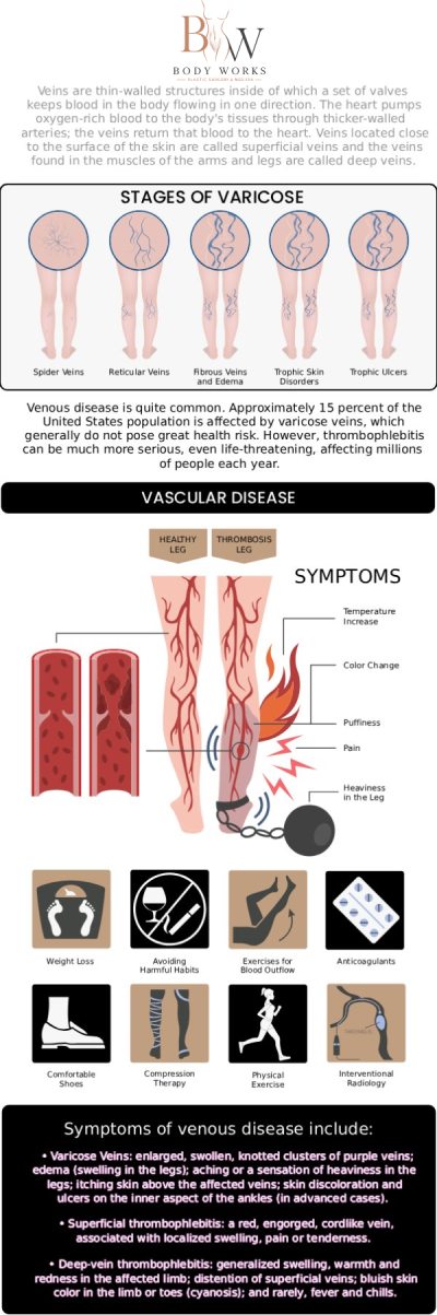 Common questions asked by patients: What are varicose veins? Are varicose veins more than just a cosmetic concern? How are varicose veins typically treated? When should I seek treatment for varicose veins at Body Works Plastic Surgery? For more information, contact us or request an appointment online. We are conveniently located at 3918 W 63rd St, Chicago, IL 60629.