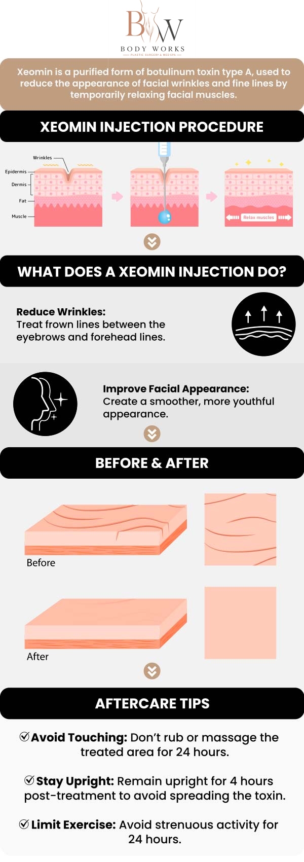 Common questions asked by patients: What makes Xeomin different from other wrinkle relaxers? How quickly will I see my results with Xeomin? How long do the wrinkle-smoothing effects of Xeomin last? Is there any downtime after getting Xeomin at Body Works Plastic Surgery? For more information, contact us or request an appointment online. We are conveniently located at 3918 W 63rd St, Chicago, IL 60629.
