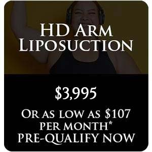 HD Arm Liposuction